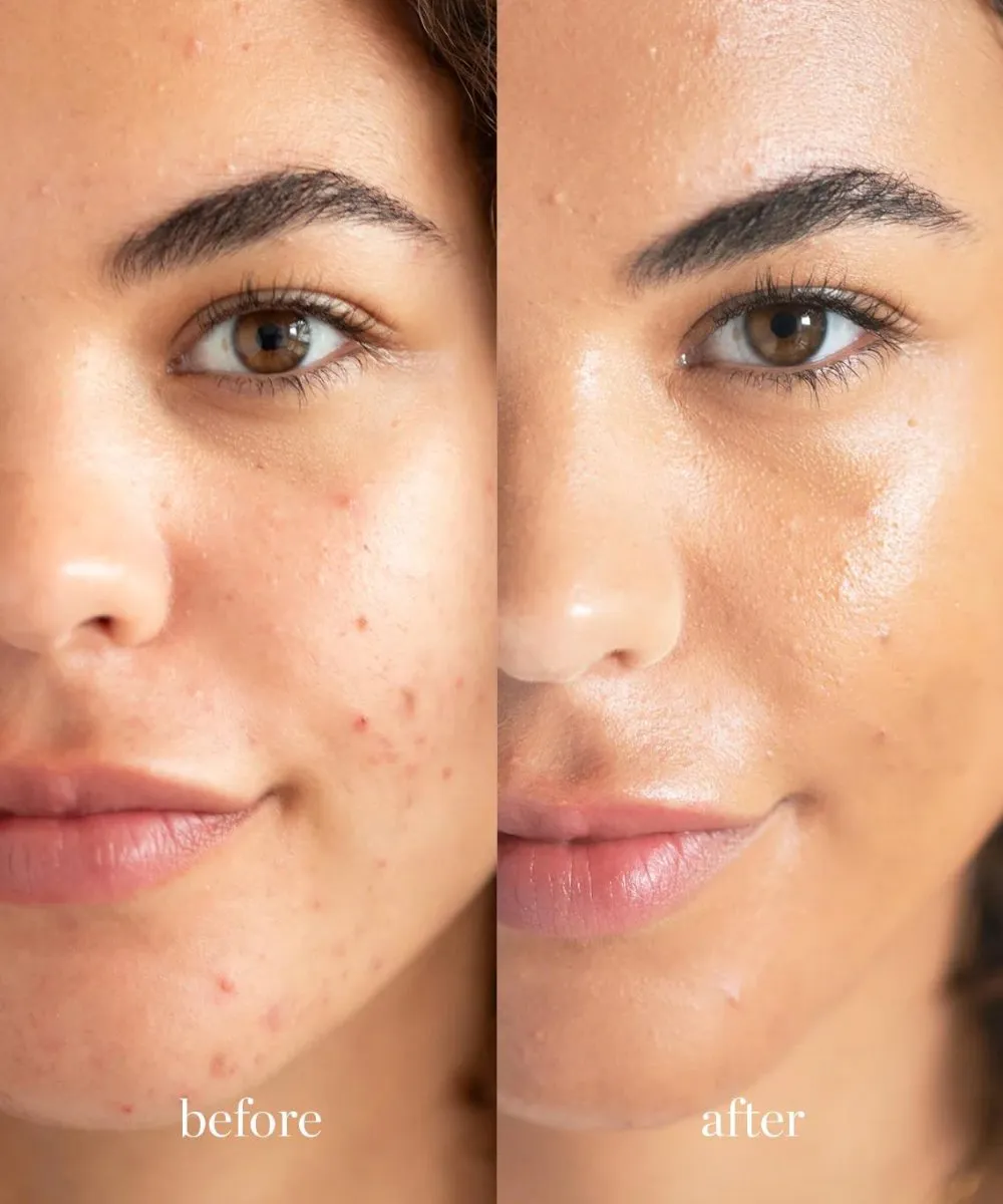 Lychee Cream Corrector